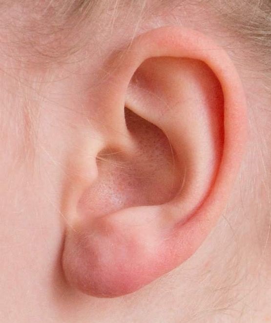 SESA conmemora el Día Internacional de la Audición y del Cuidado del Oído