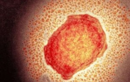 Realiza SESA vigilancia epidemiológica de viruela símica en el estado