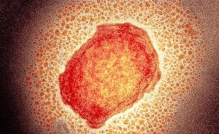 Continúa SESA vigilancia epidemiológica de viruela símica en el estado