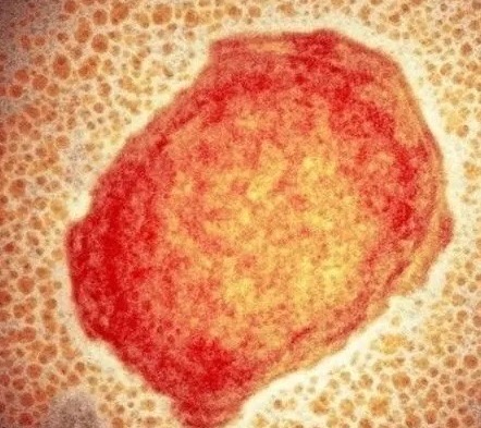 Mantiene SESA vigilancia epidemiológica en el estado de viruela símica